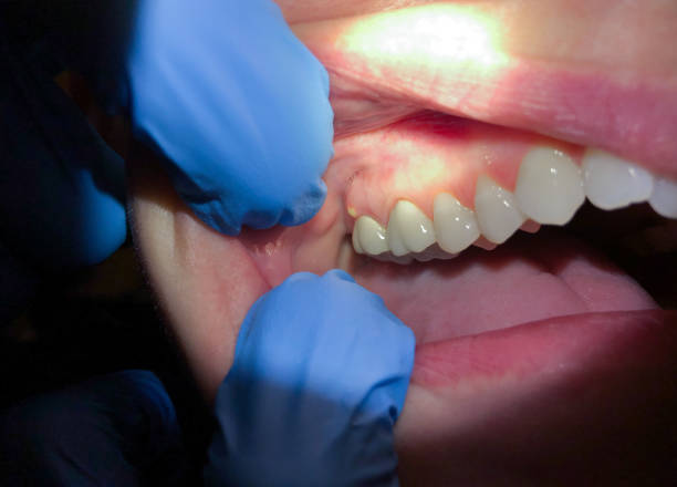 Best Emergency Treatment for Toothache in Southside, AR